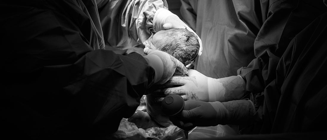 Things to Know about C-section